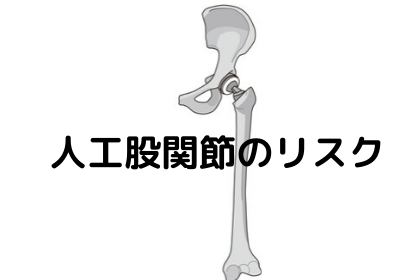 人工股関節のリスク