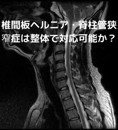 頚椎椎間板ヘルニアの画像