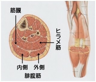 ふくらはぎの筋膜癒着