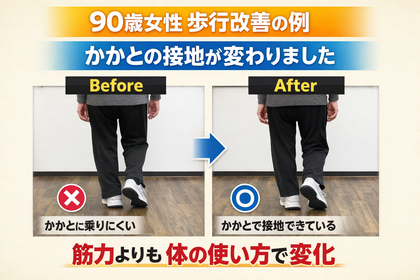 【90歳女性｜歩行改善の一例】